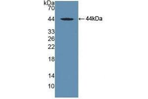 Detection of Recombinant DBP, Human using Polyclonal Antibody to Vitamin D Binding Protein (DBP) (Vitamin D-Binding Protein antibody  (AA 395-474))