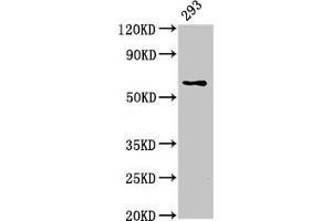 Western Blot Positive WB detected in: 293 whole cell lysate All lanes: LPCAT2 antibody at 5 μg/mL Secondary Goat polyclonal to rabbit IgG at 1/50000 dilution Predicted band size: 61, 31 kDa Observed band size: 61 kDa