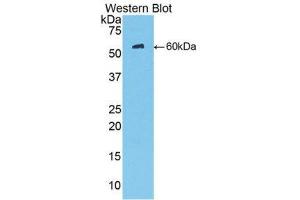 Western Blotting (WB) image for anti-Mannose-Binding Lectin (Protein C) 2, Soluble (MBL2) (AA 130-248) antibody (ABIN3206585) (MBL2 antibody  (AA 130-248))