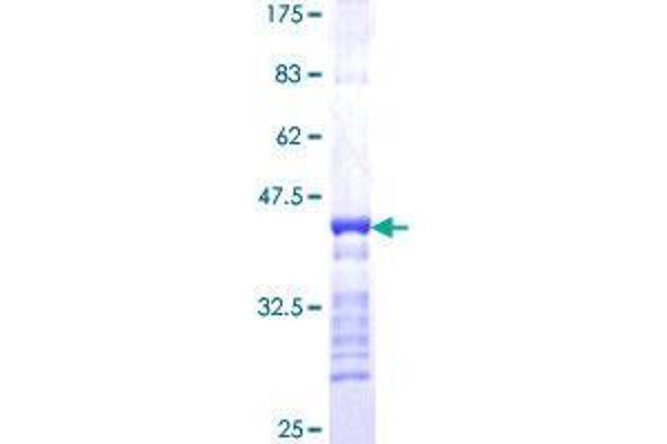 SH3D19 Protein (AA 94-203) (GST tag)