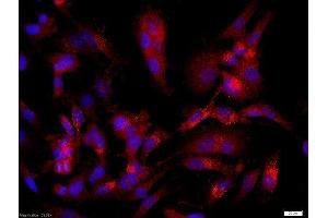 U251 cells (human glioma cells) were probed with Rabbit Anti-CASPR/Neurexin4 Polyclonal Antibody, Unconjugatedused at 1:200 dilution for 40 minutes at 37°C (CNTNAP1 antibody  (AA 151-250))