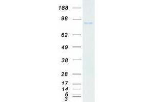 Validation with Western Blot (TLK2 Protein (Transcript Variant A) (Myc-DYKDDDDK Tag))