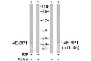 Image no. 2 for anti-Eukaryotic Translation Initiation Factor 4E Binding Protein 1 (EIF4EBP1) (pThr45) antibody (ABIN196966) (eIF4EBP1 antibody  (pThr45))