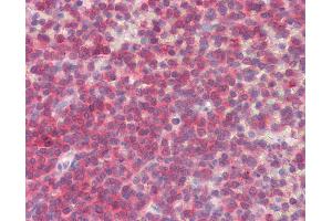 Anti-BLK antibody IHC staining of human spleen. (BLK antibody  (AA 22-34))