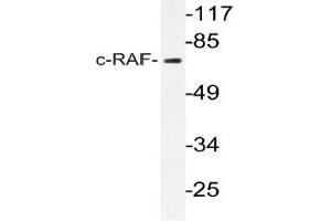 Western blot (WB) analyzes of c-RAF antibody in extracts from K562 cells. (RAF1 antibody)