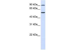 WDR34 antibody used at 1 ug/ml to detect target protein. (WDR34 antibody  (C-Term))