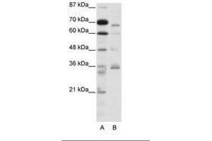 Image no. 1 for anti-Proprotein Convertase Subtilisin/kexin Type 6 (PCSK6) (AA 301-350) antibody (ABIN202833) (PCSK6 antibody  (AA 301-350))