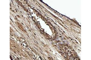 IHC analysis of YWHAE using anti-YWHAE antibody (ABIN7600163). (YWHAE antibody  (AA 16-163))