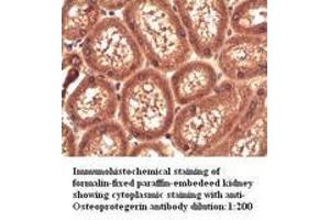 Image no. 1 for anti-Tumor Necrosis Factor Receptor Superfamily, Member 11b (TNFRSF11B) antibody (ABIN790903) (Osteoprotegerin antibody)
