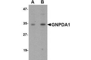 Western blot analysis of GNPDA1 in mouse kidney lysate with AP30368PU-N GNPDA1 antibody at (A) 1 and (B) 2 μg/ml. (GNPDA1 antibody  (C-Term))