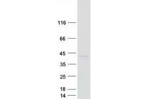 Validation with Western Blot (alpha-N-Acetylgalactosaminide alpha-2,6-Sialyltransferase 3 (SIA7C) protein (Myc-DYKDDDDK Tag))