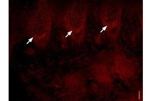 Expression of NaV1. (SCN3A antibody  (Intracellular))