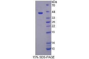 SDS-PAGE analysis of Mouse TSTA3 Protein.
