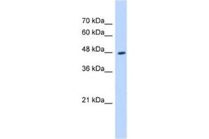 Western Blotting (WB) image for anti-Hydroxyacyl-CoA Dehydrogenase/3-Ketoacyl-CoA Thiolase/enoyl-CoA Hydratase (Trifunctional Protein), beta Subunit (HADHB) antibody (ABIN2463135) (HADHB antibody)