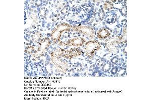 Rabbit Anti-PPP1R8 Antibody  Paraffin Embedded Tissue: Human Kidney Cellular Data: Epithelial cells of renal tubule Antibody Concentration: 4. (PPP1R8 antibody  (Middle Region))