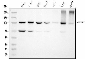 Western blot analysis of MCM6 using anti-MCM6 antibody (ABIN7600038). (MCM6 antibody  (AA 14-821))