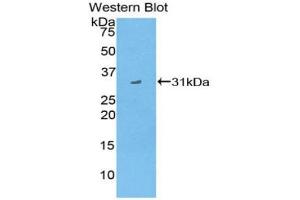 Western blot analysis of the recombinant protein. (CD1d antibody  (AA 64-298))