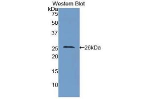 Western Blotting (WB) image for anti-Intercellular Adhesion Molecule 4 (ICAM4) (AA 32-226) antibody (ABIN1859244) (ICAM4 antibody  (AA 32-226))