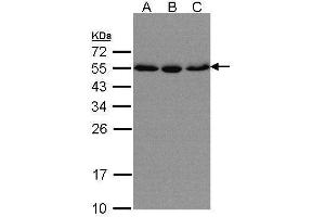 WB Image Sample(30 μg of whole cell lysate) A:HeLa S3, B:Hep G2, C:MOLT4, 10% SDS PAGE antibody diluted at 1:500 (KPNA2 antibody  (C-Term))