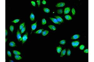 Immunofluorescent analysis of A549 cells using ABIN7157107 at dilution of 1:100 and Alexa Fluor 488-congugated AffiniPure Goat Anti-Rabbit IgG(H+L) (IDH3A antibody  (AA 28-108))