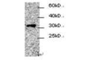 Image no. 1 for anti-Cell Division Cycle Associated 4 (CDCA4) antibody (ABIN791547) (CDCA4 antibody)