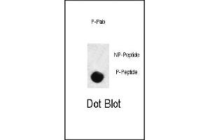 Dot blot analysis of anti-hSD3- Phospho-specific Pab (ABIN389656 and ABIN2850451) on nitrocellulose membrane. (SMAD3 antibody  (pSer208))