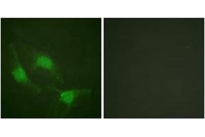 Immunofluorescence analysis of HeLa cells, using p53 (Ab-382) Antibody. (p53 antibody  (AA 344-393))