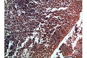 Immunohistochemical analysis of paraffin-embedded human-tonsil, antibody was diluted at 1:200 (Tenascin R antibody  (AA 1270-1350))