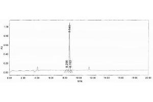 Image no. 2 for Neurofilament, Light Polypeptide (NEFL) peptide (Ovalbumin) (ABIN5666290) (Neurofilament, Light Polypeptide (NEFL) peptide (Ovalbumin))