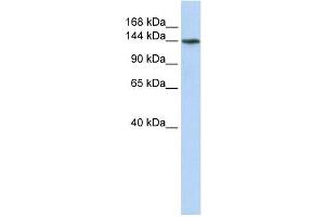 ATP11B antibody used at 1 ug/ml to detect target protein.