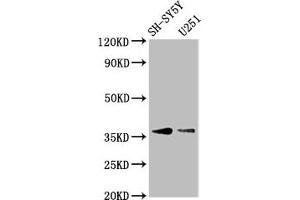 Western Blot Positive WB detected in: SH-SY5Y whole cell lysate, U251 whole cell lysate All lanes: BARHL1 antibody at 3.
