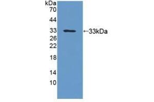 Detection of Recombinant UPb1, Human using Polyclonal Antibody to Beta-ureidopropionase (UPB1) (UPB1 antibody  (AA 121-384))