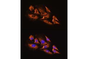 Immunofluorescence analysis of C6 cells using A Rabbit pAb (ABIN3016751, ABIN3016752, ABIN3016753 and ABIN6219833) at dilution of 1:100. (ADRA2A antibody  (AA 240-380))