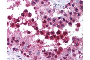 Anti-CUL9 / Cullin 9 antibody IHC of human testis. (CUL9 antibody  (C-Term))