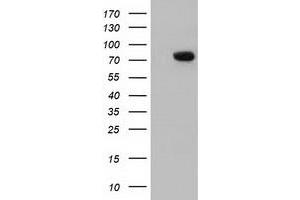 HEK293T cells were transfected with the pCMV6-ENTRY control (Left lane) or pCMV6-ENTRY ARHGAP25 (Right lane) cDNA for 48 hrs and lysed. (ARHGAP25 antibody)