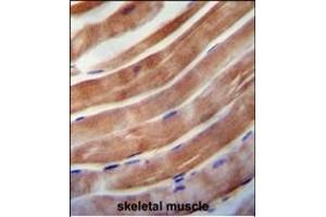 KE antibody (C-term) 0092b immunohistochemistry analysis in formalin fixed and paraffin embedded human skeletal muscle followed by peroxidase conjugation of the secondary antibody and DAB staining.