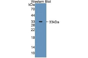 Western blot analysis of the recombinant protein. (Protein phosphatase 1 (AA 433-636), (Regulatory Subunit 15A) antibody)