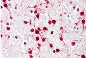 Human Brain, Cortex: Formalin-Fixed, Paraffin-Embedded (FFPE) (DELE1/KIAA0141 antibody  (N-Term))