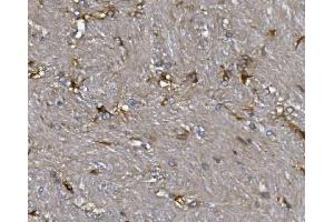 IHC analysis of ALDH1L1 using anti-ALDH1L1 antibody (ABIN7601093). (ALDH1L1 antibody  (AA 282-424))