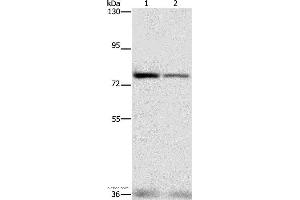 Western blot analysis of HepG2 and hela cell, using NFE2L1 Polyclonal Antibody at dilution of 1:280 (NFE2L1 antibody)