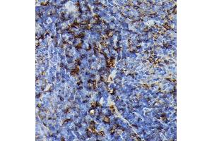 Immunohistochemistry of paraffin-embedded rat spleen using FADD Rabbit mAb (ABIN7267135) at dilution of 1:100 (40x lens). (FADD antibody)