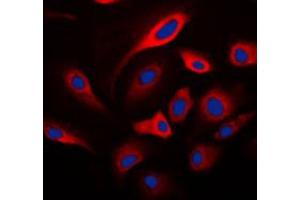 Immunofluorescent analysis of HADH2 staining in SKNSH cells. (HSD17B10 antibody  (Center))