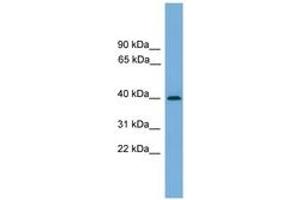 Image no. 1 for anti-serpin Peptidase Inhibitor, Clade B (Ovalbumin), Member 8 (SERPINB8) (AA 251-300) antibody (ABIN6745215) (SERPINB8 antibody  (AA 251-300))