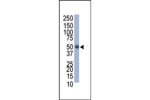 Western blot analysis of anti-Protein-C tag Pab (ABIN387853 and ABIN2843196) in Protein-C-tagged recombinant protein bacterial lysate. (PROC antibody)