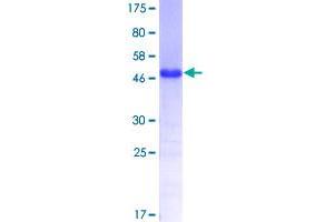 TBX3 Protein (AA 311-410) (GST tag)