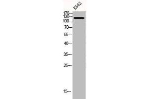 Western Blot analysis of K562 cells using COL2A1 Polyclonal Antibody (COL2A1 antibody  (N-Term))