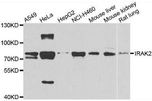 Western blot analysis of extracts of various cell lines, using IRAK2 antibody. (IRAK2 antibody  (AA 1-270))