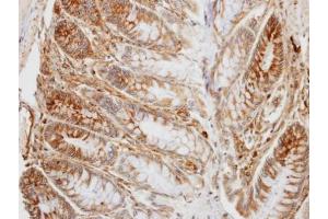 IHC-P Image Immunohistochemical analysis of paraffin-embedded human colon, using PD-L1, antibody at 1:100 dilution. (PD-L1 antibody  (C-Term))