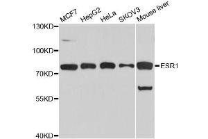 Western blot analysis of extracts of various cell lines, using ESR1 antibody.