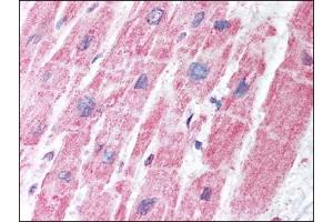 Image no. 1 for anti-Malate Dehydrogenase 1, NAD (Soluble) (MDH1) antibody (ABIN372198) (MDH1 antibody)